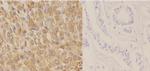 Phospho-Cytokeratin 18 (Ser52) Antibody in Immunohistochemistry (Paraffin) (IHC (P))