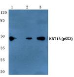 Phospho-Cytokeratin 18 (Ser52) Antibody in Western Blot (WB)