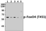 Phospho-FOXO4 (Thr451) Polyclonal Antibody