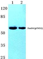 Phospho-FOXO4 (Thr451) Antibody in Western Blot (WB)