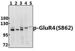 Phospho-GluR4 (Ser862) Polyclonal Antibody
