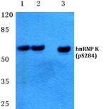 Phospho-hnRNP K (Ser284) Polyclonal Antibody