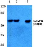 Phospho-hnRNP K (Ser284) Antibody in Western Blot (WB)