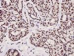 Phospho-FOXO3A (Ser253) Polyclonal Antibody