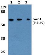 Phospho-FOXO4 (Ser197) Antibody in Western Blot (WB)