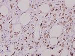 Phospho-AKT2 (Ser474) Polyclonal Antibody