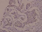 Phospho-Zap-70 (Tyr319) Antibody in Immunohistochemistry (Paraffin) (IHC (P))