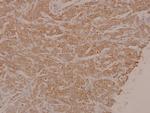 Phospho-MEK1/MEK2 (Ser222, Ser226) Polyclonal Antibody