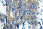 Phospho-beta Catenin (Ser33) Antibody in Immunohistochemistry (Paraffin) (IHC (P))