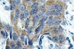 Phospho-beta Catenin (Ser33) Antibody in Immunohistochemistry (Paraffin) (IHC (P))