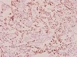 Phospho-BRCA1 (Ser1423) Polyclonal Antibody