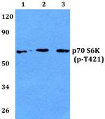 Phospho-p70 S6 Kinase (Thr421) Antibody in Western Blot (WB)