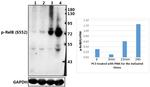 Phospho-RelB (Ser552) Antibody in Western Blot (WB)