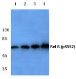 Phospho-RelB (Ser552) Antibody in Western Blot (WB)