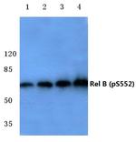 Phospho-RelB (Ser552) Antibody in Western Blot (WB)