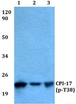 Phospho-CPI-17 (Thr38) Antibody in Western Blot (WB)