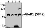 Phospho-GluR1 (Ser849) Polyclonal Antibody