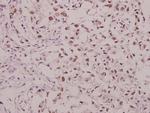 Phospho-GluR1 (Ser863) Polyclonal Antibody