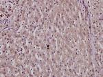 Phospho-HNF4A (Ser313) Polyclonal Antibody