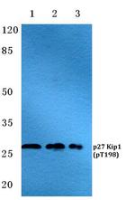 Phospho-p27 Kip1 (Thr198) Polyclonal Antibody