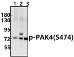 Phospho-PAK4/6/7 (Ser474) Antibody in Western Blot (WB)
