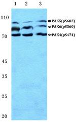 Phospho-PAK4/6/7 (Ser474) Polyclonal Antibody