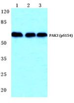 Phospho-PAK3 (Ser154) Polyclonal Antibody