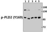 Phospho-PLD2 (Tyr169) Polyclonal Antibody