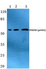 Phospho-PFKFB2 (Ser483) Antibody in Western Blot (WB)
