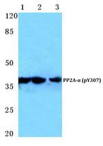 Phospho-PP2A alpha (Tyr307) Antibody in Western Blot (WB)