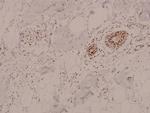 Phospho-AMPK alpha-1,2 (Thr183, Thr172) Polyclonal Antibody