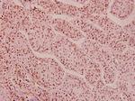 Phospho-HDAC1 (Ser421, Ser423) Antibody in Immunohistochemistry (Paraffin) (IHC (P))
