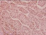Phospho-HDAC1 (Ser421, Ser423) Antibody in Immunohistochemistry (Paraffin) (IHC (P))