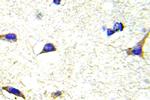 LIMK1/LIMK2 Antibody in Immunohistochemistry (Paraffin) (IHC (P))
