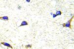 LIMK1/LIMK2 Polyclonal Antibody