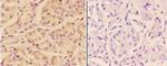 Adenylate Cyclase 9 Polyclonal Antibody