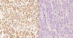 AKAP8 Antibody in Immunohistochemistry (Paraffin) (IHC (P))