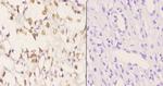 AKAP8 Polyclonal Antibody