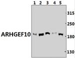 ARHGEF10 Polyclonal Antibody
