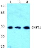 CHST1 Polyclonal Antibody