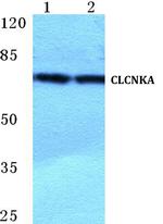 CLCNKA Polyclonal Antibody