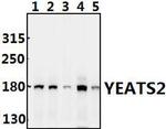 YEATS2 Antibody in Western Blot (WB)