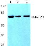 SLC28A2 Polyclonal Antibody