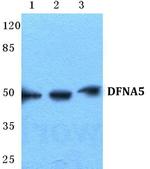 DFNA5 Antibody in Western Blot (WB)