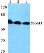 SLC6A1 Polyclonal Antibody