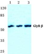 GLRB Polyclonal Antibody