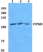 ITPKB Polyclonal Antibody
