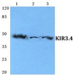 Kir3.4 (KCNJ5) Antibody in Western Blot (WB)