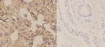 KCNAB3 Polyclonal Antibody