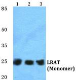 LRAT Polyclonal Antibody